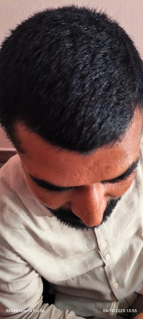 After treatment