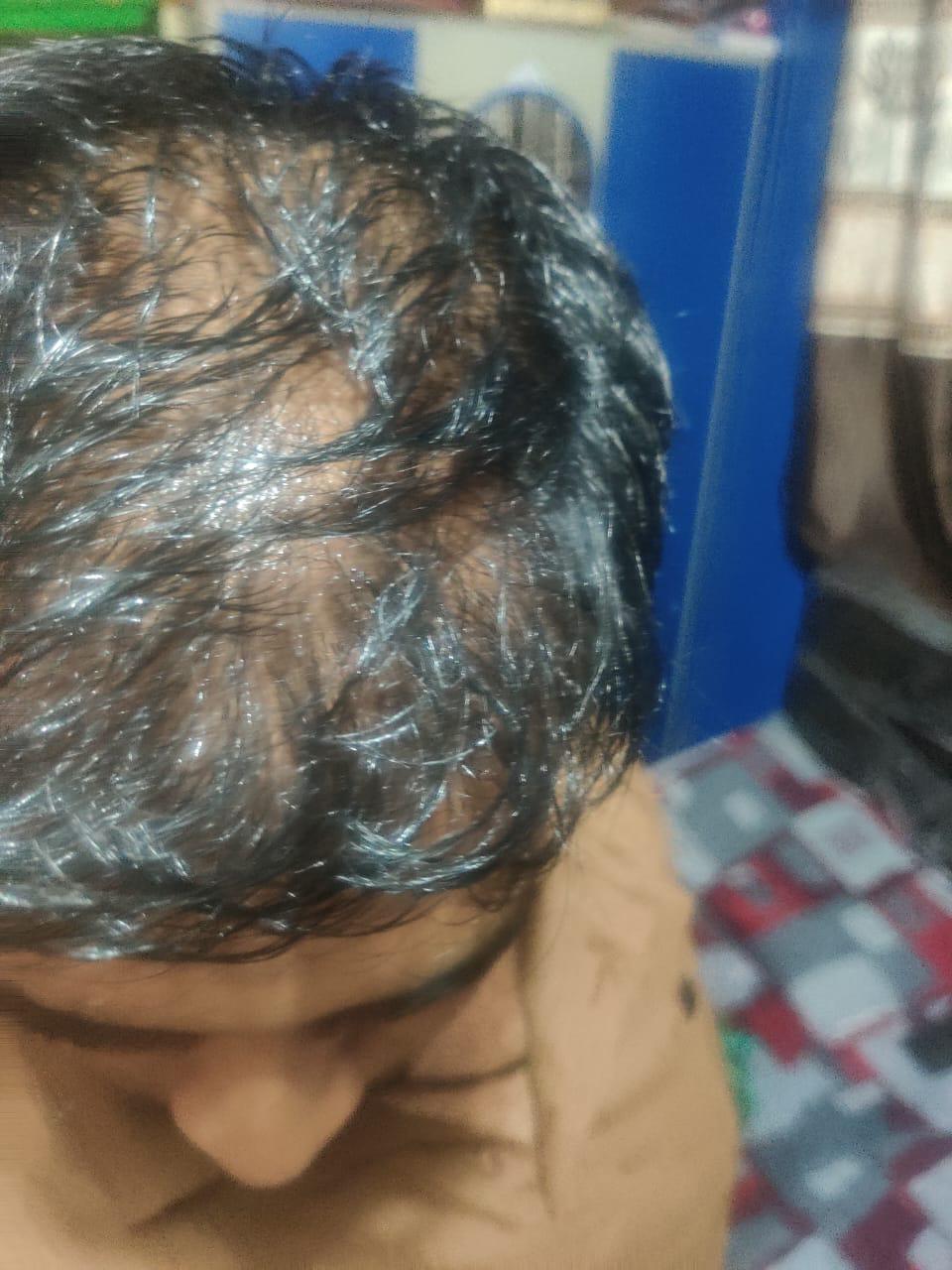 Before treatment
