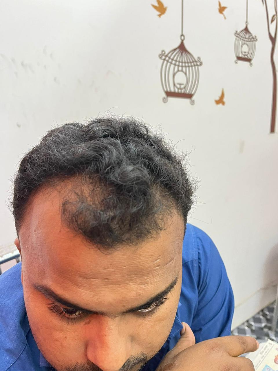 Before treatment