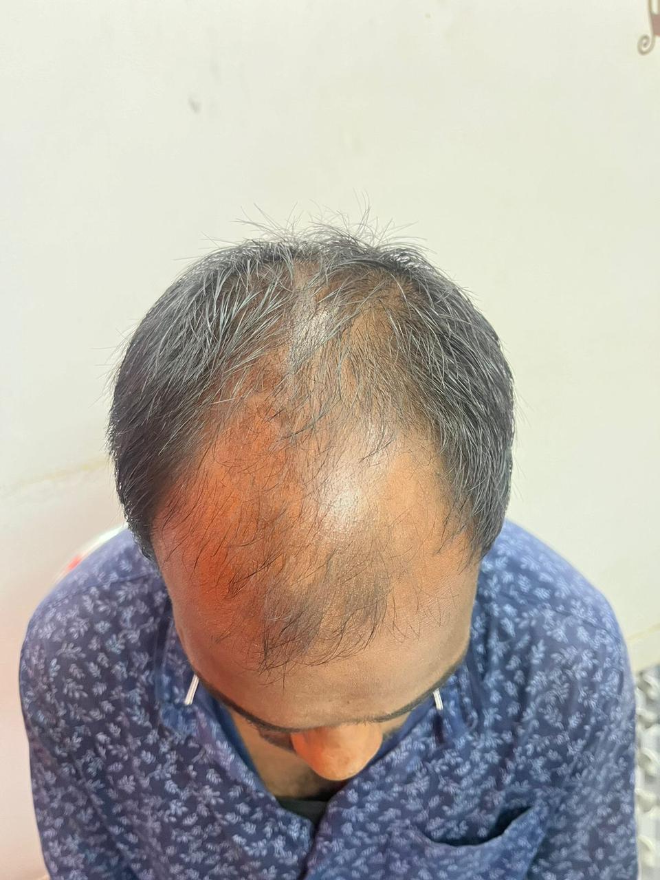 Before treatment