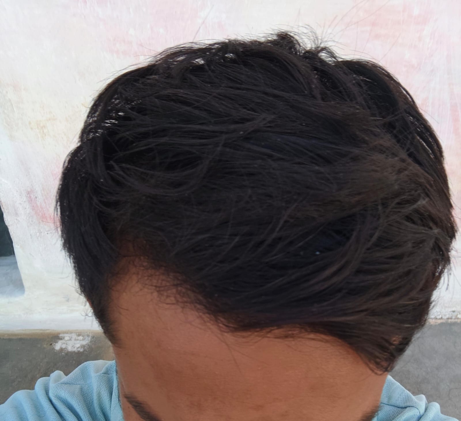After treatment