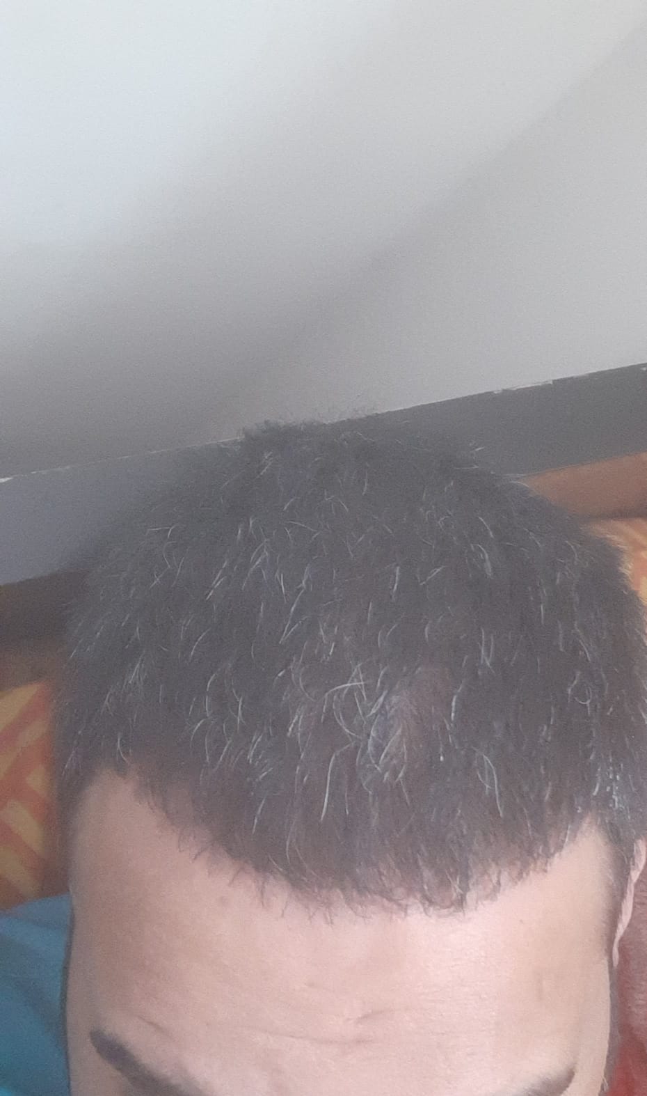Before treatment