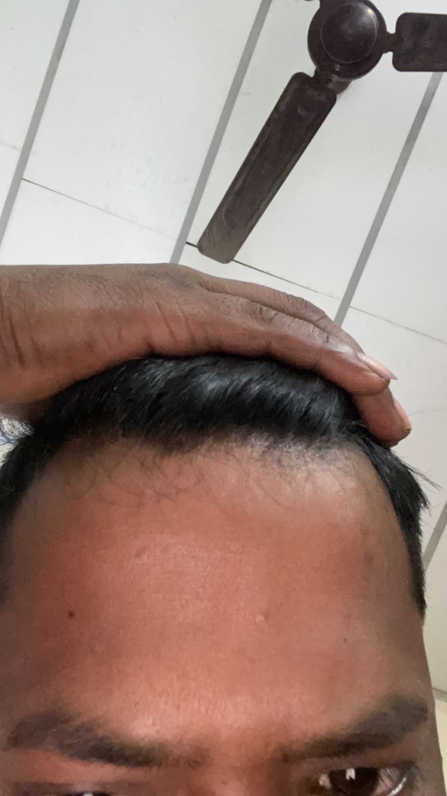Before treatment