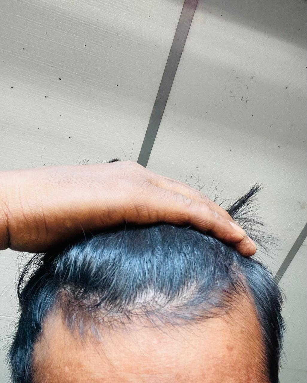 After treatment
