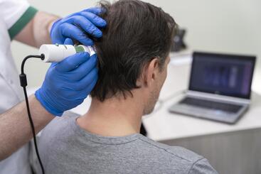 Scalp Analysis